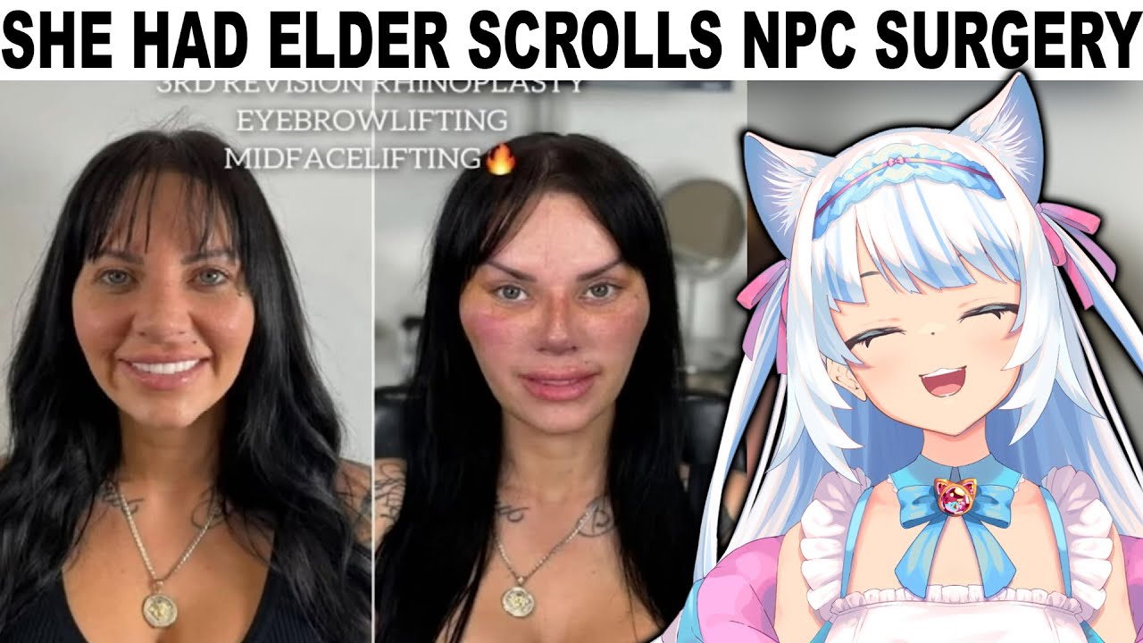 ELDER SCROLLS NPC SURGERY IS WILD | Sentences you never heard before (EmKay Reaction)