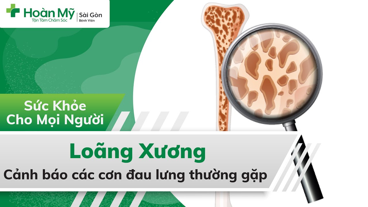 Loãng xương | Dấu hiện nhận biết, Điều trị, Ăn uống và Phòng bệnh