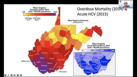 Hepatitis C: Elimination in the US and Updated Models of Care