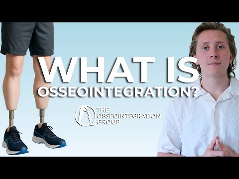 What is Osseointegration? video thumbnail