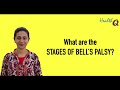 WHAT ARE DIFFERENT STAGES OF BELLS PALSY