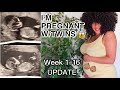 I'M PREGNANT W/TWINS!! DR. DRAMA, EARLY SYMPTOMS + GENDER REVEAL