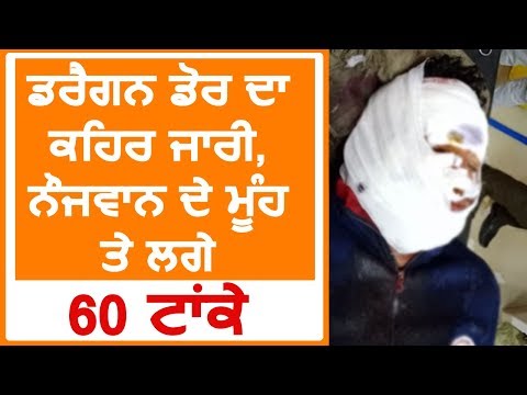 नहीं थम रहा China Dor का कहर, Ropar के व्यक्ति को लगे 60 टांके