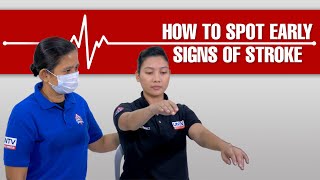 How to Spot Early Signs of Stroke #LIFESAVERPH