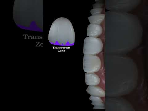 AHA Dental Motion Graphics — Awareness Content