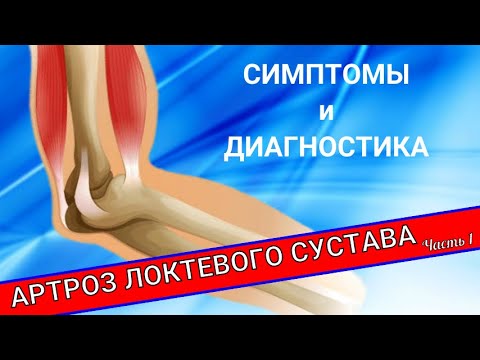 АРТРОЗ ЛОКТЕВОГО СУСТАВА (Часть 1)