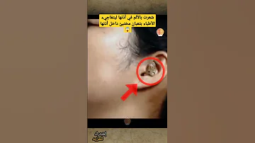 ذهبت للطبيب بعدما شعرت بالتعب ولكن ما حدث كان مدهش Shorts 