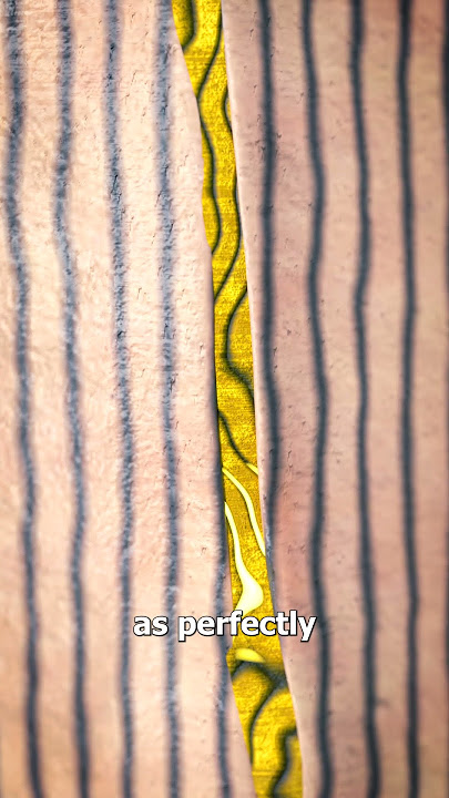 How Scars Form 🤕