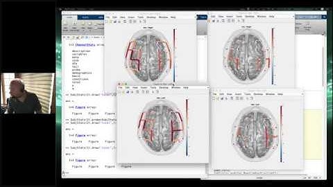Motion Correction Walkthrough in NIRS Toolbox (Brain AnalyzIR) with Dr. Ted Huppert