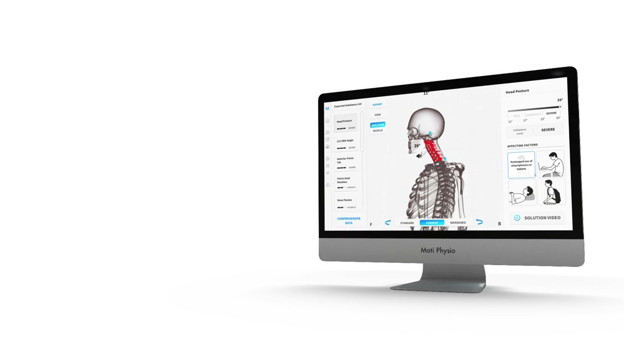 Moti Physio software – head posture in the ideal, current and worsened stage