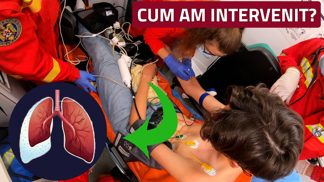 Lipsa de aer in statia de autobuz (pacient tanar) - De garda pe SMURD