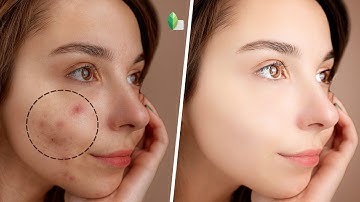 Remove Pimples And Skin Smooth Editing | Skin Glowing | Snapseed Tutorial