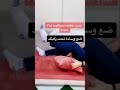 الم الركبة