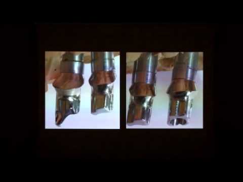 Dott. Rosario Prisco - Il disegno dei pilastri in metallo in implantoprotesi