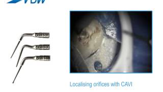 VDW Dental · How To: VDW.ULTRA - Localising orifices with CAVI