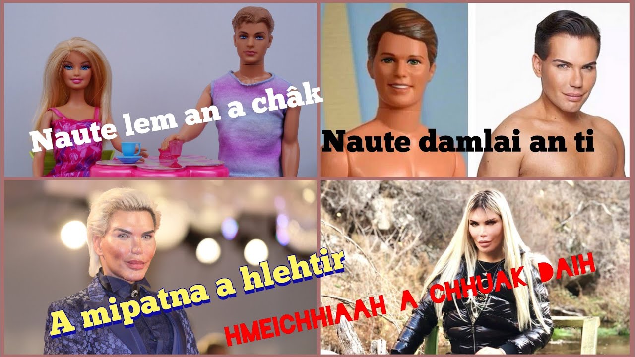 Vawi 72 zet Plastic Surgery a tih hnu chuan...