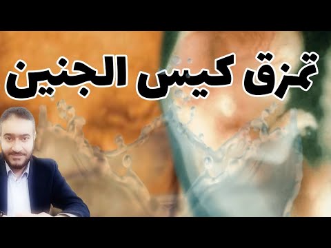 فيديو: متى تتمزق الأغشية أثناء الحمل؟