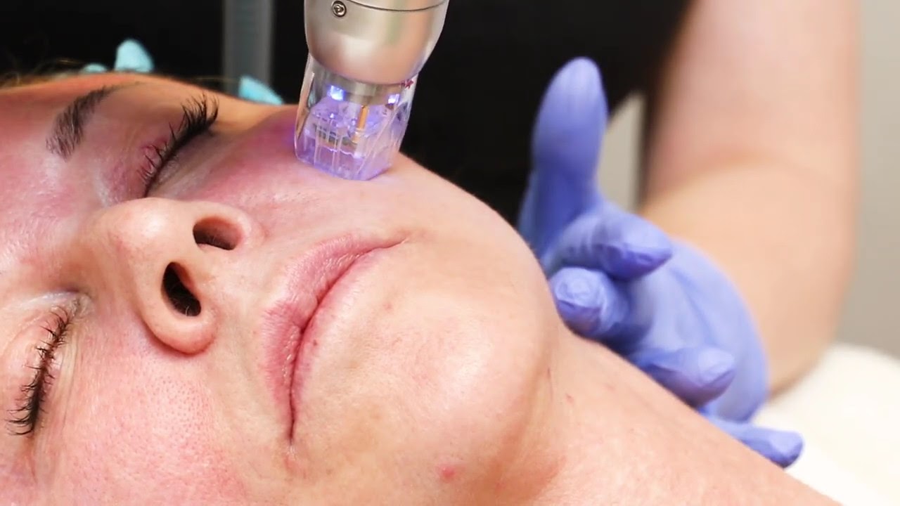 Rf Spa - Làn Sóng Làm Đẹp Mới Của Công Nghệ Hiện Đại