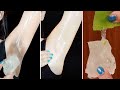 Live Result In Just 10 Minutes ! Whitening Dark Underarms Challenge