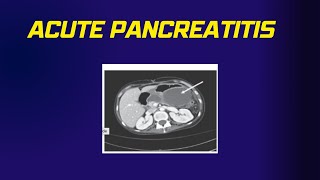 Acute Pancreatitis