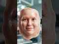 Your skin can fix itself- Watch this omg