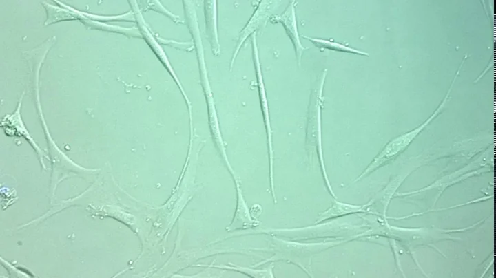 Fibroblasts irradiated by 2 Gy ionizing radiation