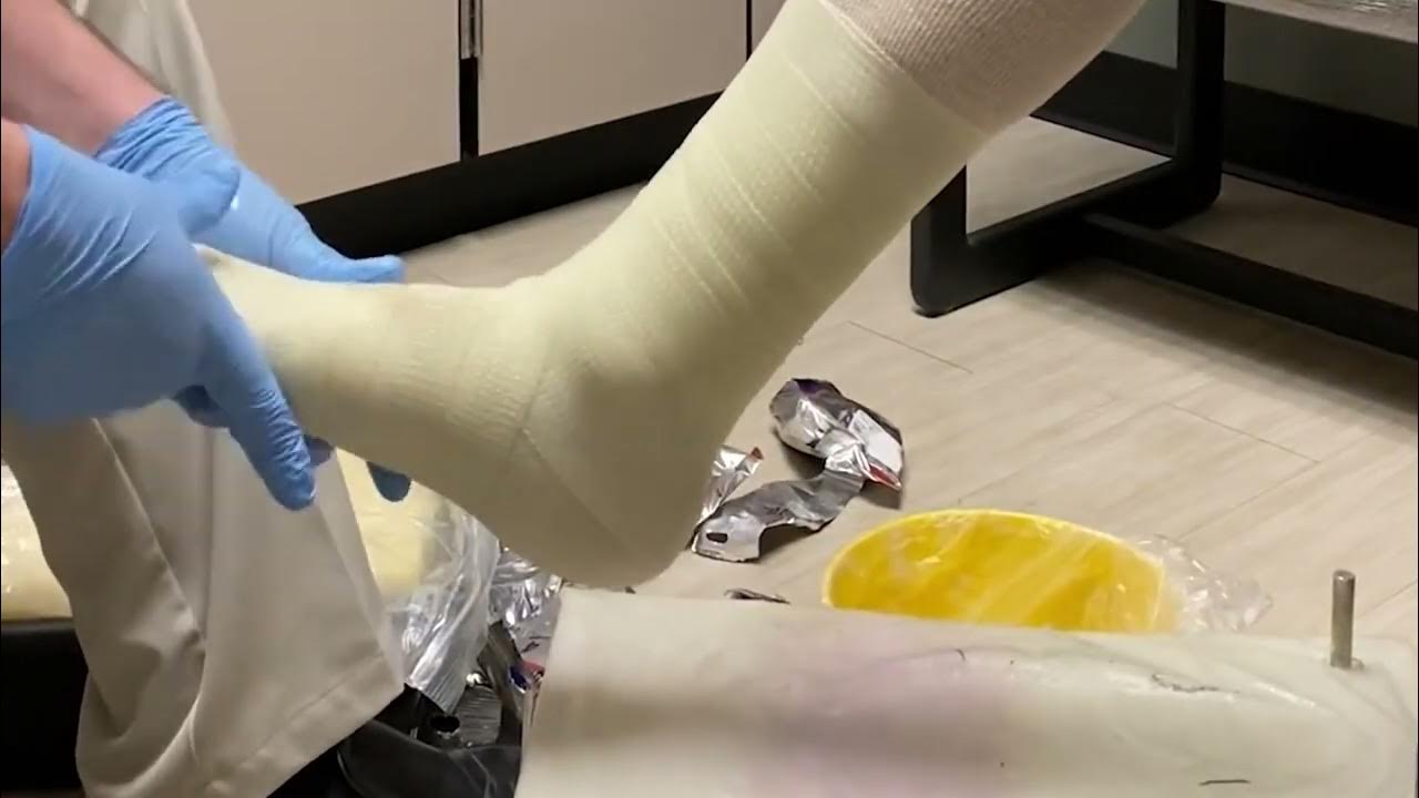 Cornerstone Dynamic Brace Casting Process YouTube