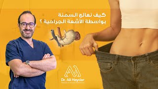 What is Bariatric Surgery | Dr. Ali Haydar | ما هي عملية السمنة؟