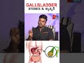 #gallbladder cancer & stones #health #dranilkumar #shorts #ytshorts