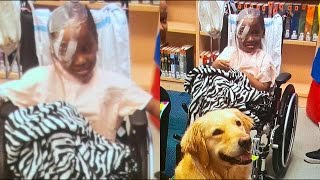 Mother Of Girl Recovering From Dog Bite Say Daughter Is Improving