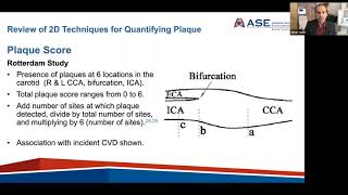 Carotid Arterial Plaque by Ultrasound - Characterization of Atherosclerosis & Evaluation of CV Risk