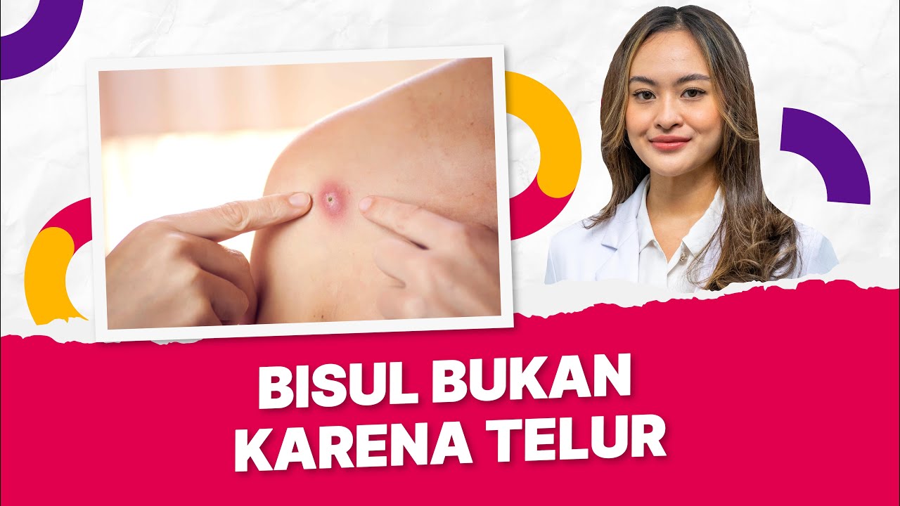 Ternyata Bisul Timbul Bukan karena Konsumsi Telur
