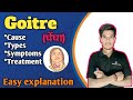 Goitre in hindi|Thyroid gland disorder|Cause, types, symptoms, treatment #nursing #biology #science
