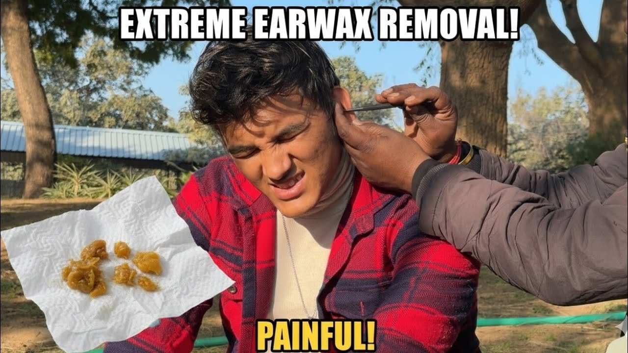 HARD EARCLOG 😱REMOVAL AND HARD DEEP CLEANING PROCESS WITH DEEP RELAXATION EARCLEANING ASMR|ASMR MAN 