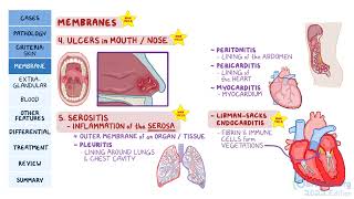 Systemic Lupus Erythematosus (SLE) | Osmosis Pathology Review