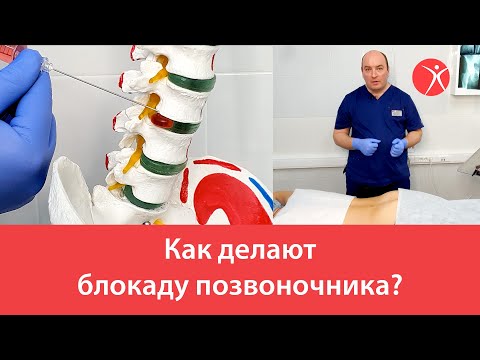 Как делают блокаду позвоночника?