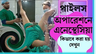 Piles Surgery Under Saddle Block Anaesthesia #Piles #Agartala #Bangladesh