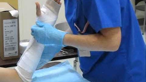 Radial Gutter Splint