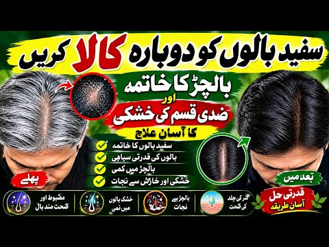  How To Reduce Grey Hair, Hair Fall & Stubborn Dandruff | Easy Natural Hair Remedy