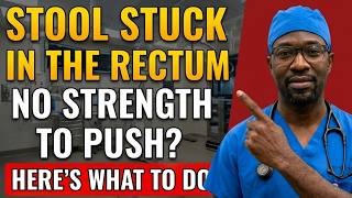 Stool STUCK in the Rectum! What is it and what to do? | Doctor Explains