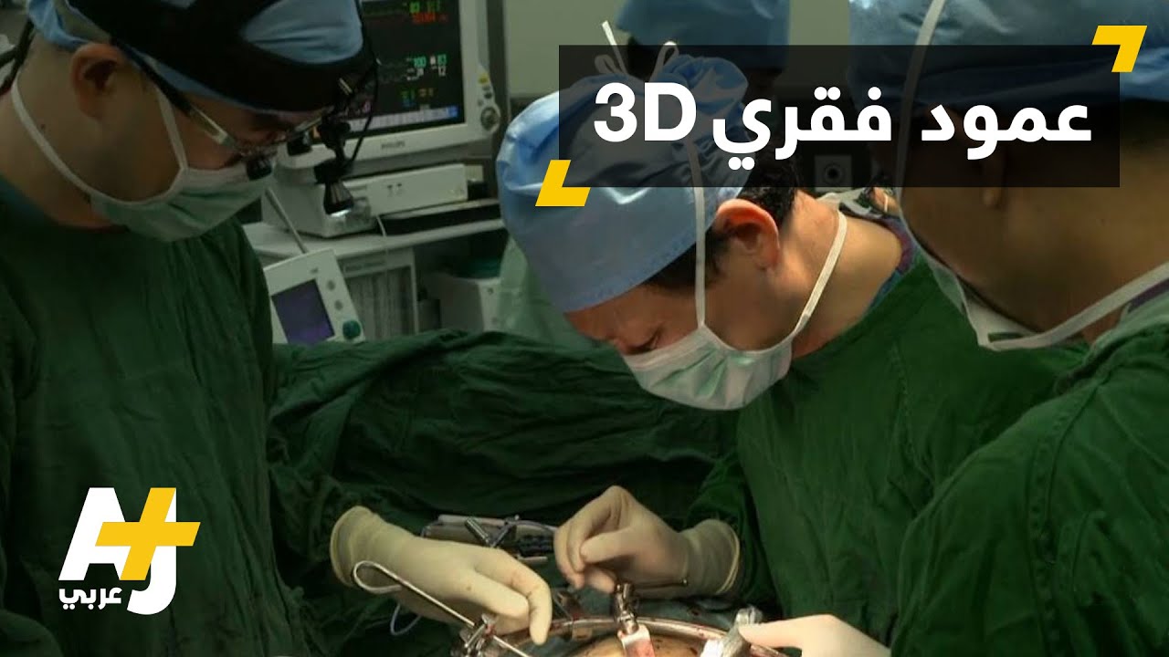 جراحة العمود الفقري بالتقنية ثلاثية الأبعاد