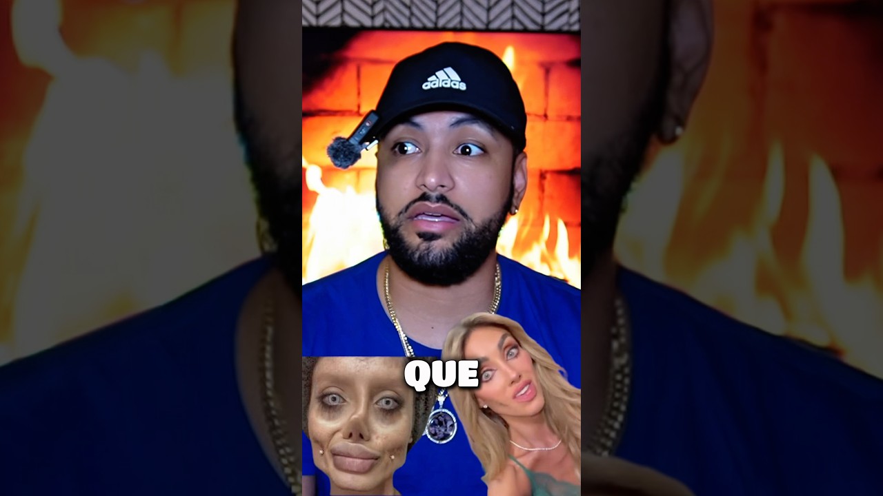 CANTANTE ANAHI TIENE RECAÍDA CON SU ENFERMEDAD? SU CAMBIO FÍSICO LO DICE TODO🚨