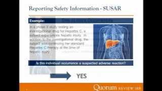 Understanding Reporting Obligations to the IRB webinar 5 13 2014 Final