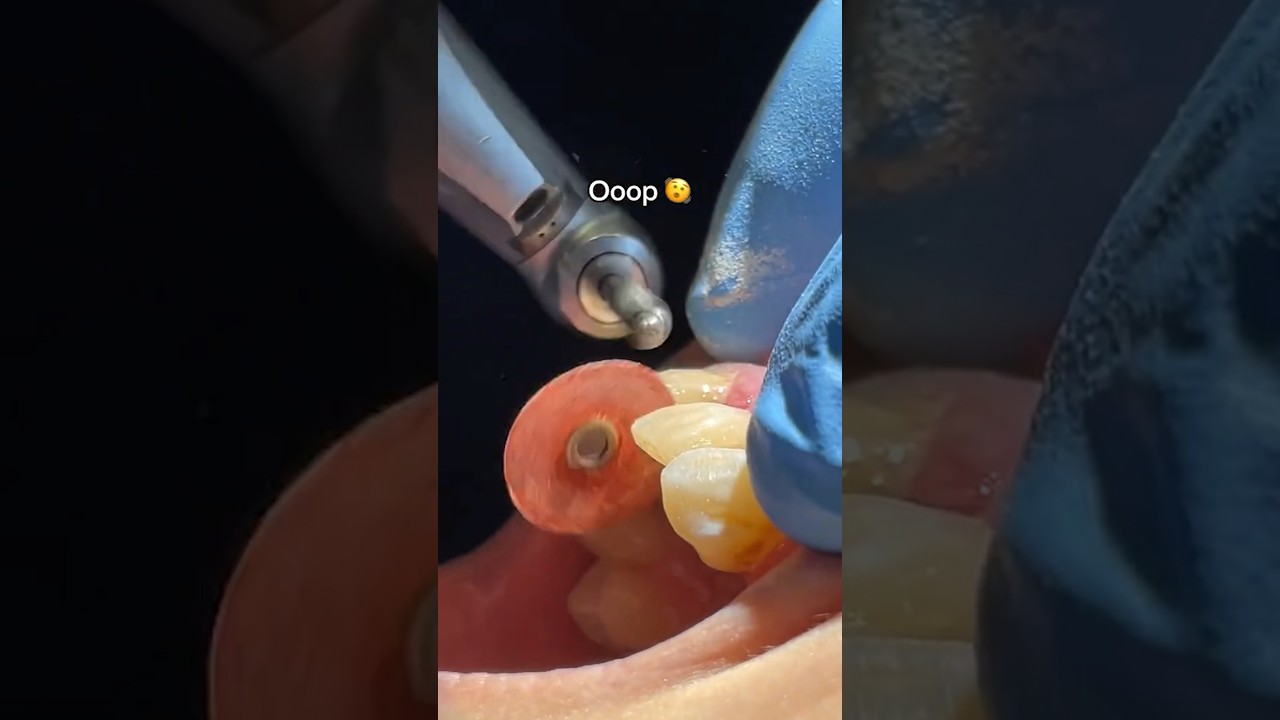 When Your Dentist Appointment goes WRONG 😬🦷