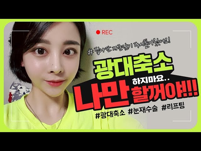 광대축소술 결과가 궁금해? 티안나게 자연스러운 수술후기! [티에스성형외과]