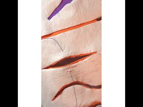 Sutura Sarnoff