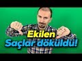 Ekilen salar dkld! | 7. hafta geride kald? PRP yapt?rd?m