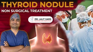 THYROID NODULE TREATMENT WITHOUT SURGERY | THYROID RFA | HINDI | Dr. Lalit Garg |