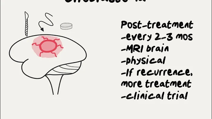 Doctor Explains Glioblastoma and How it is Treated