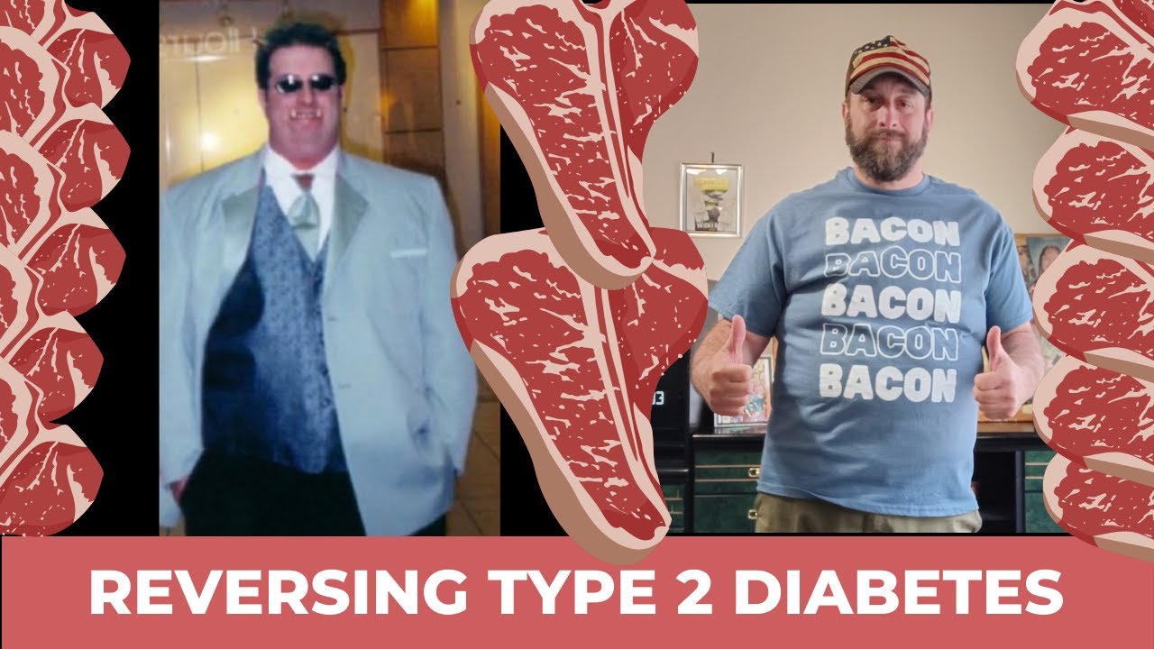 Type II Diabetic Amputee Reversing Diabetes on Carnivore Diet | Thomas Pruett EP 38